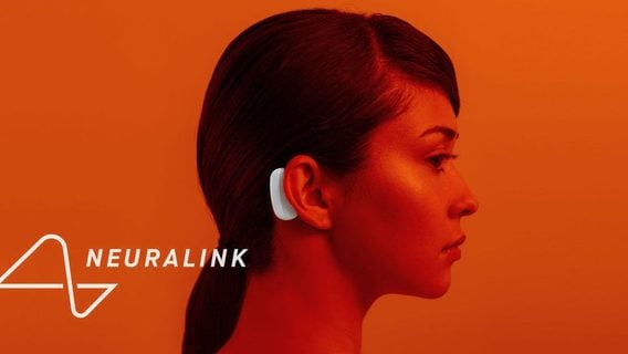 Тысячи людей хотят вживить чип Neuralink: стартап набирает добровольцев