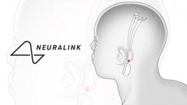 Neuralink ищет компанию для начала испытаний нейрочипа на людях