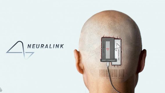 Neuralink впервые вживила чип в мозг человека