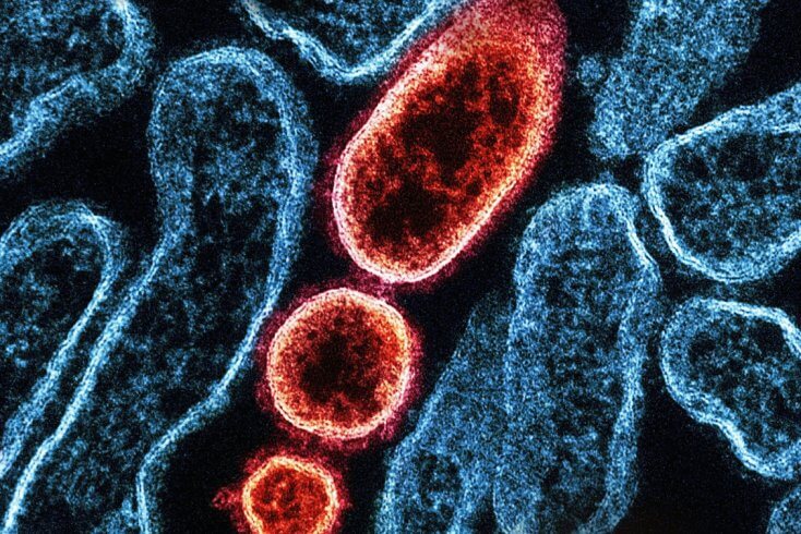 Минздрав считает минимальным риск распространения в Беларуси вируса Нипах