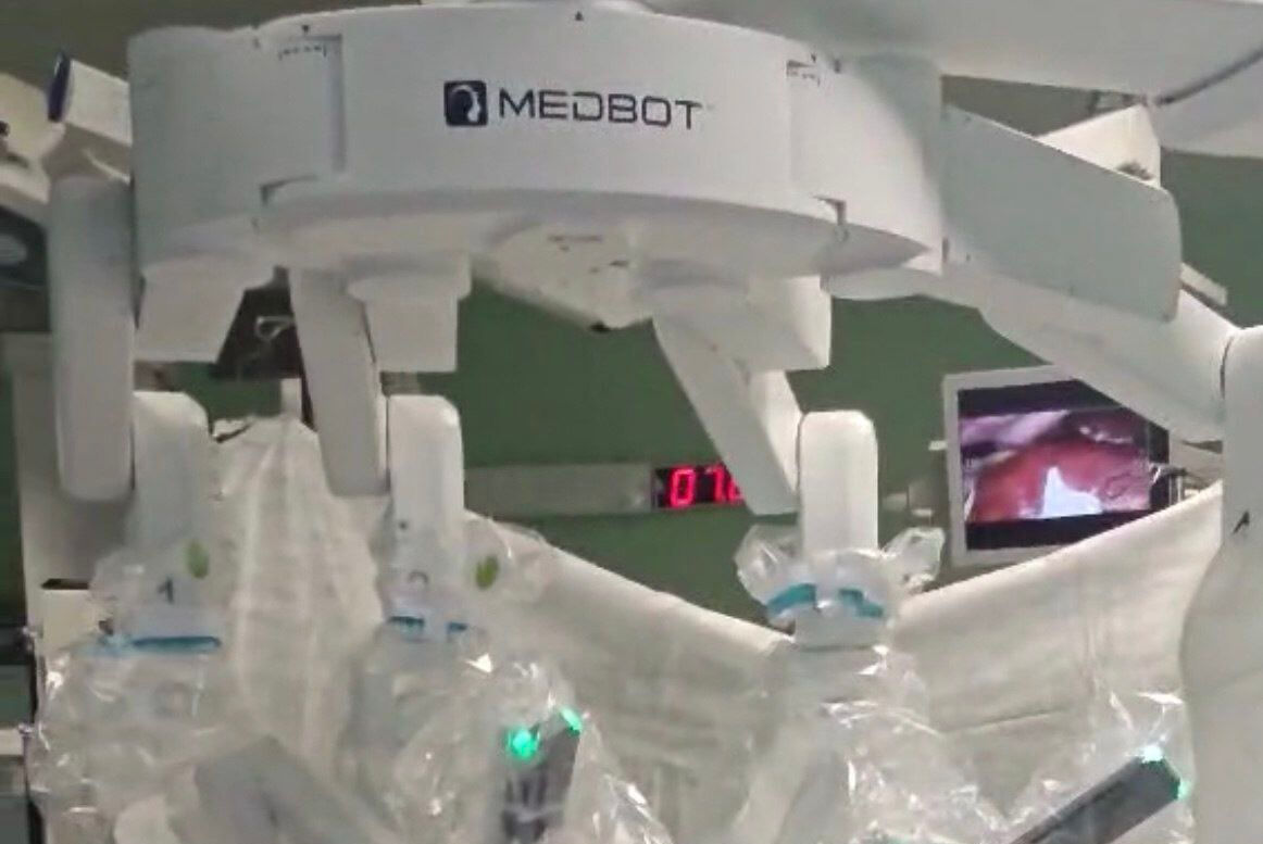 Minsk’s transplant center performs first hepatectomy using robotic system