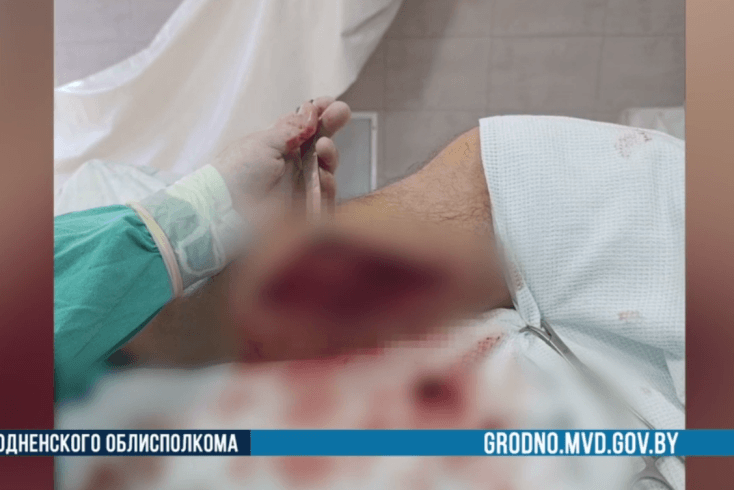 Гродненская милиция сообщила о госпитализации мужчины, получившего огнестрельные ранения в Польше 